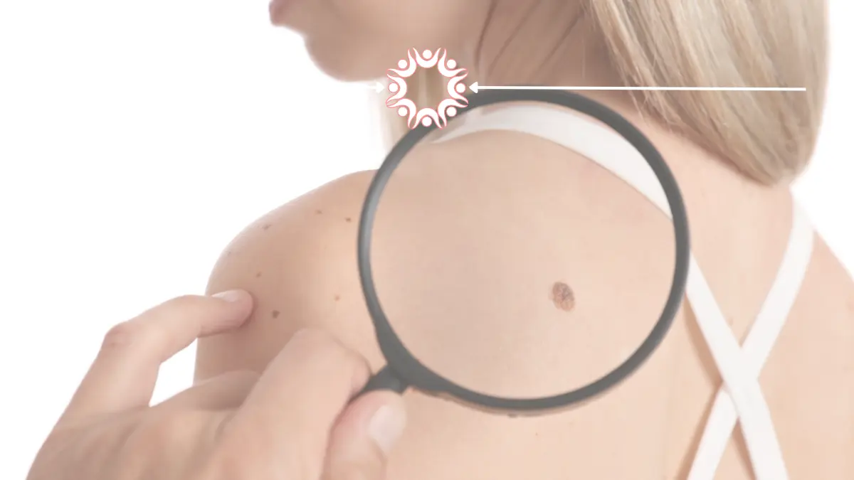 Dermatology questions answered by RAMC Dermatologist Sarah Motl